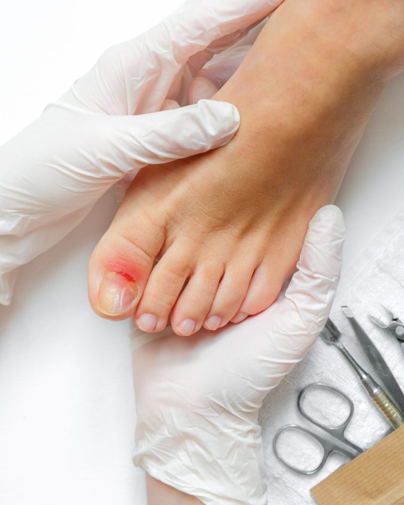 optimised pedicure-podologist-patient-on-medical-pedicure-2023-03-22-09-44-59-utc (2)